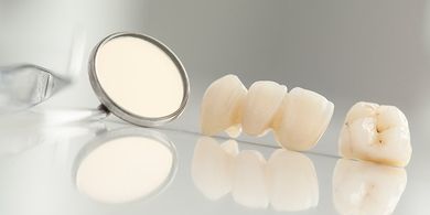 Dental Crown — Quincy, MI — Family Dental Home
