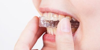 Occlusal Guard — Quincy, MI — Family Dental Home Occlusal Guard — Quincy, MI — Family Dental Home