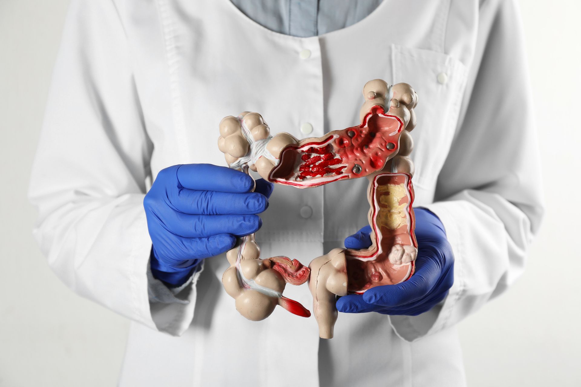 A doctor is holding a model of the colon in her hands.