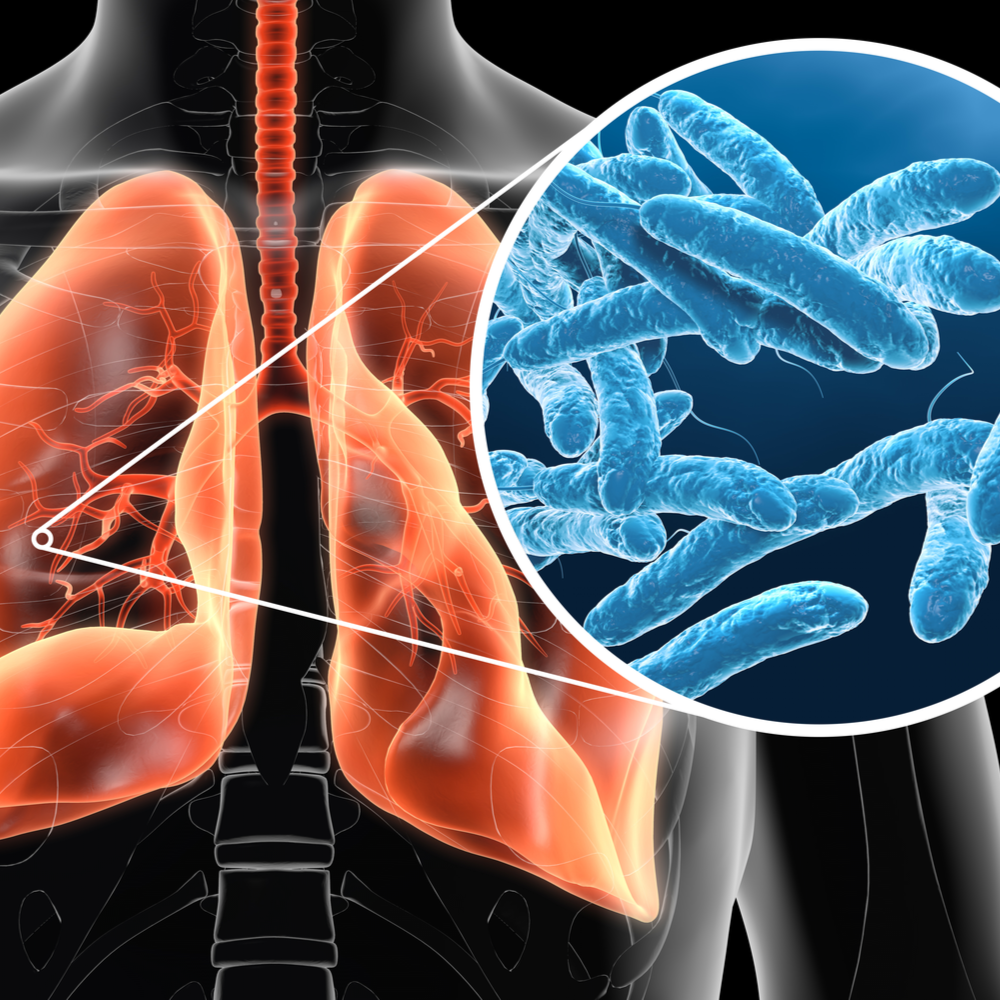 Legionella Risk Assessments (Domestic)