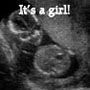 Ultrasound scan with the text “It’s a girl!”