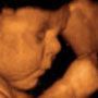 Close-up of a fetus in orange ultrasound image, curled with face visible