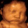 Blurry close-up of a face in warm orange tones, with a hand partially covering the mouth.