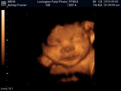 3D ultrasound of a fetus in the womb with a curled profile on a black background