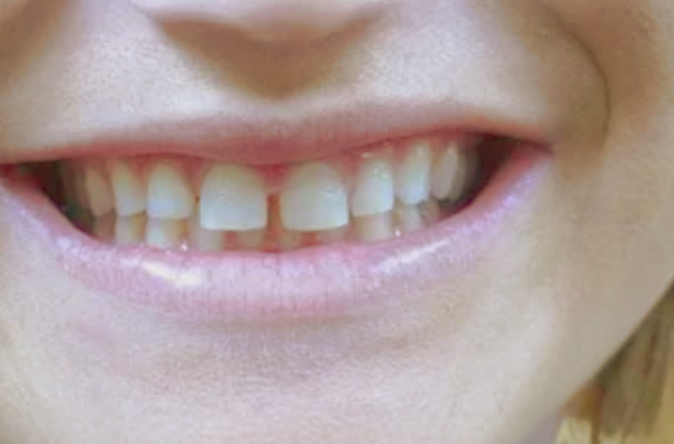 Close-up of a smiling mouth showing teeth and pink lips
