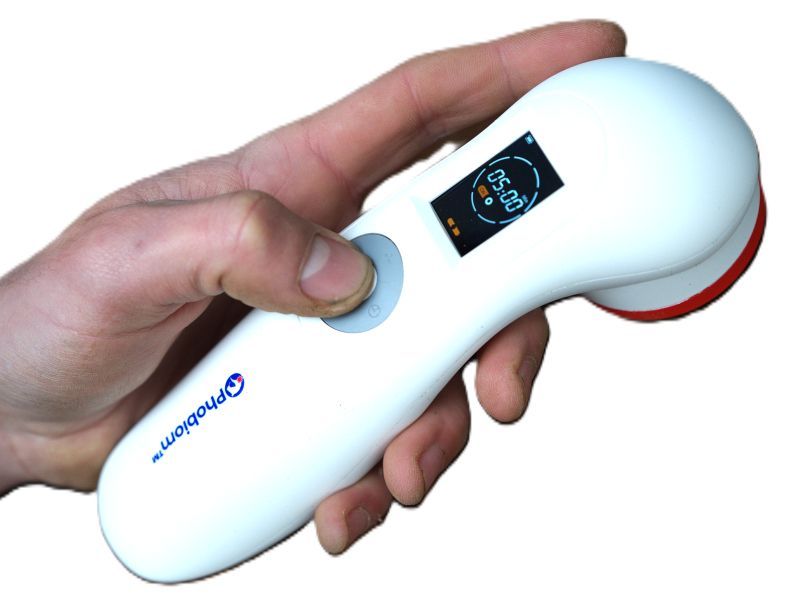 Handheld Phobiom laser apparaat