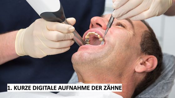 CEREC: Digitale Aufnahme