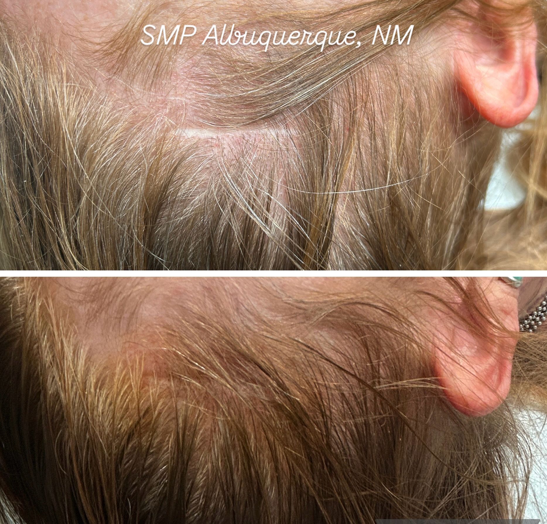 smp in Albuquerque