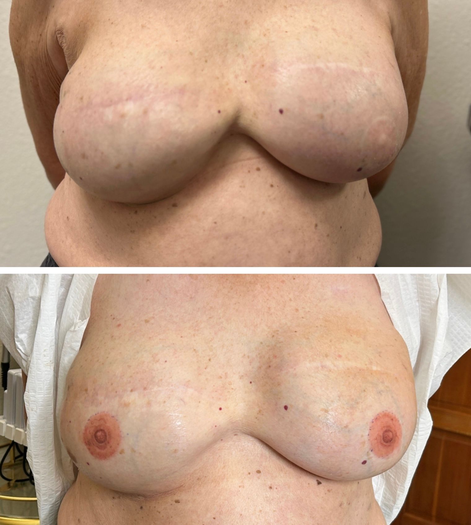 3D Areaola's near me