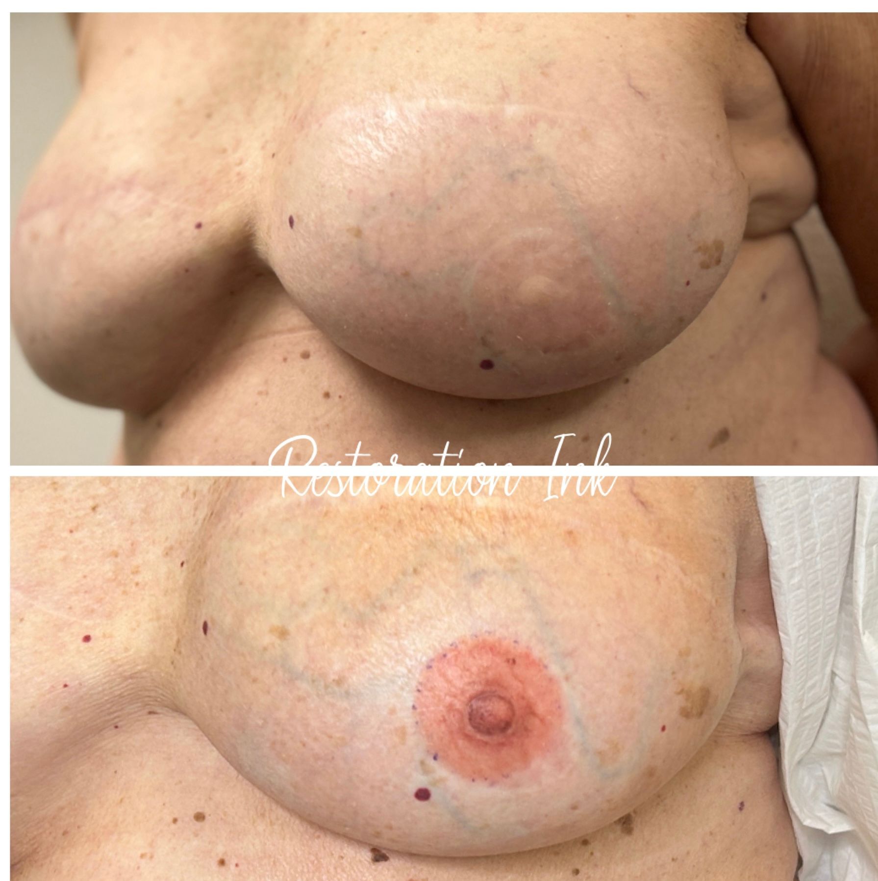 3D Areola Albuquerque, NM