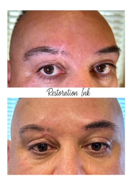 Scar camouflage tattoo before and after in Albuquerque
