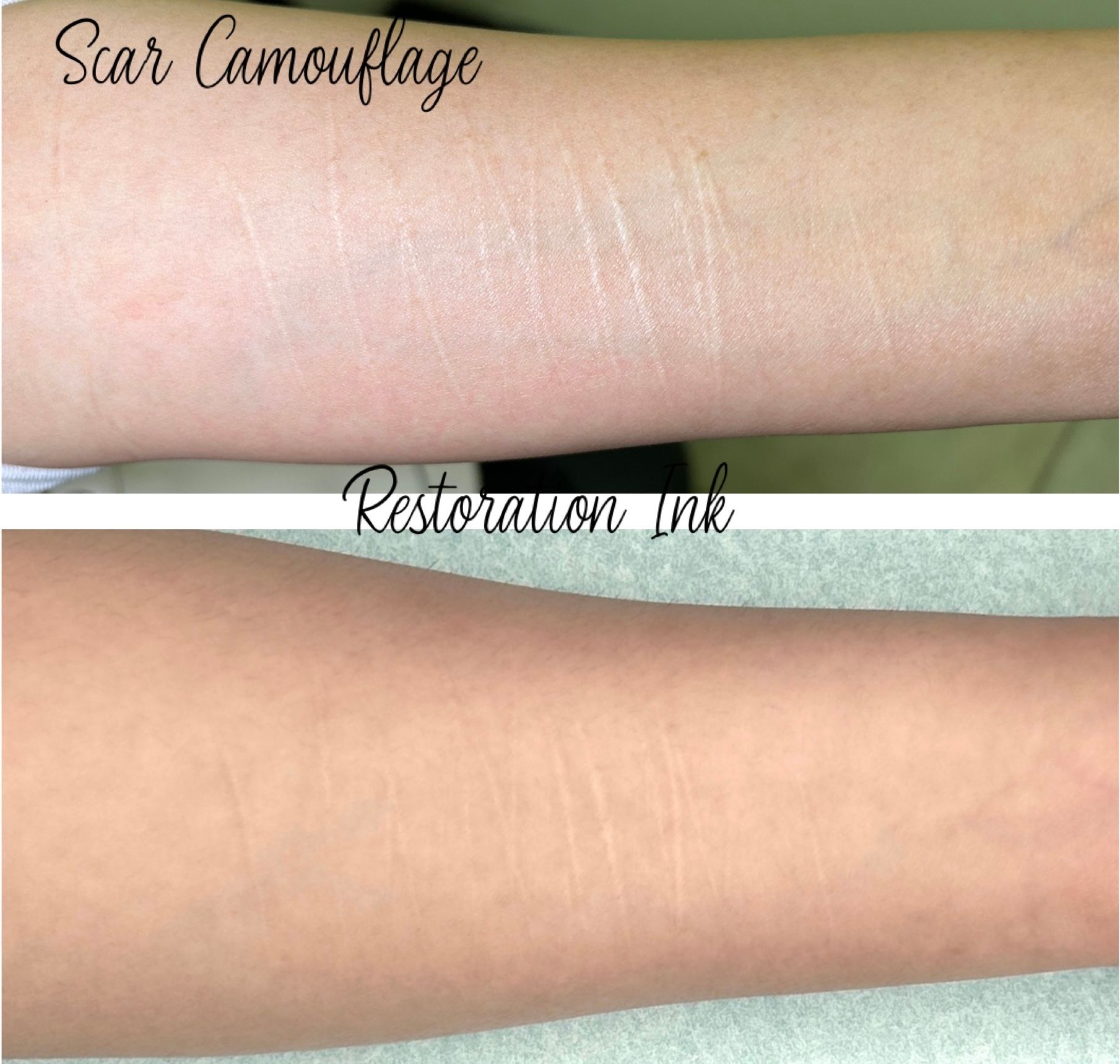 Self harm scar camouflage tattoo before and after in Albuquerque, nm