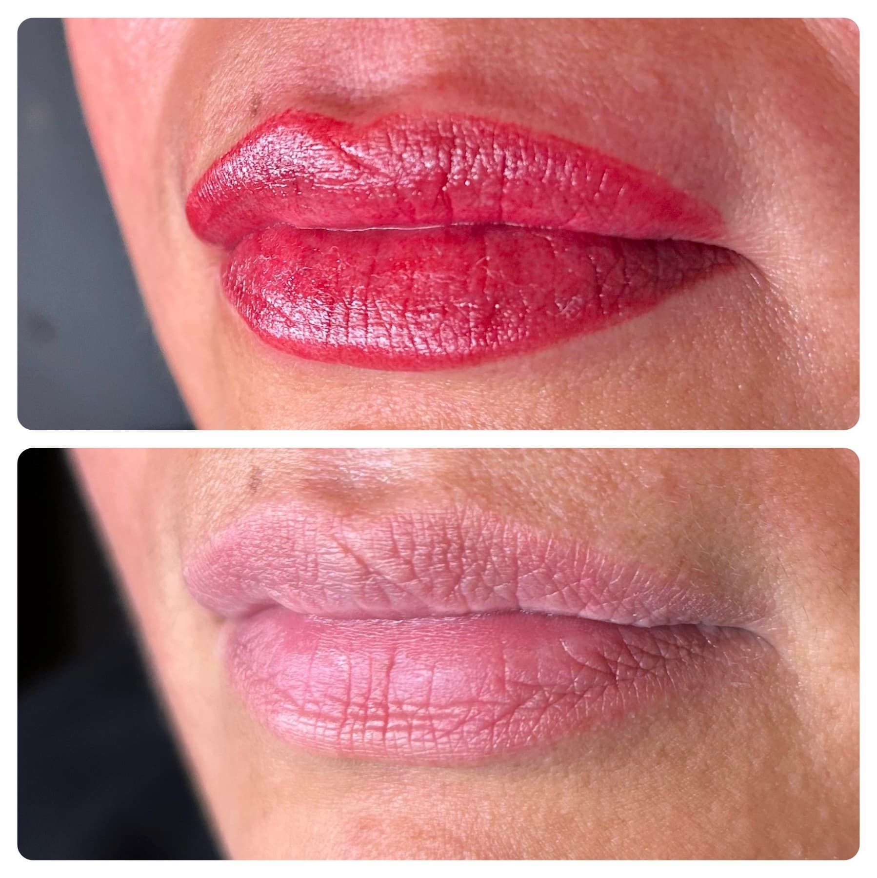 Liip Blush before amd after near me
