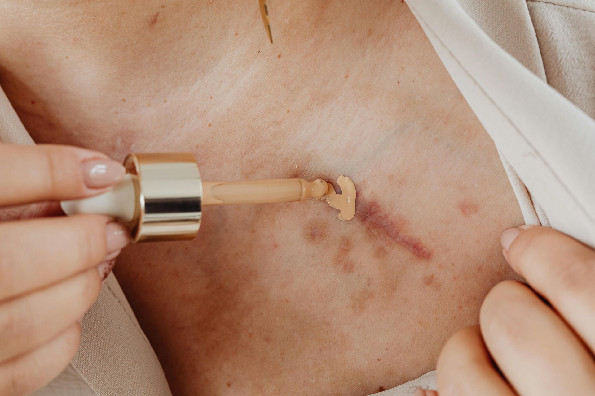 Inkless Scar Revision