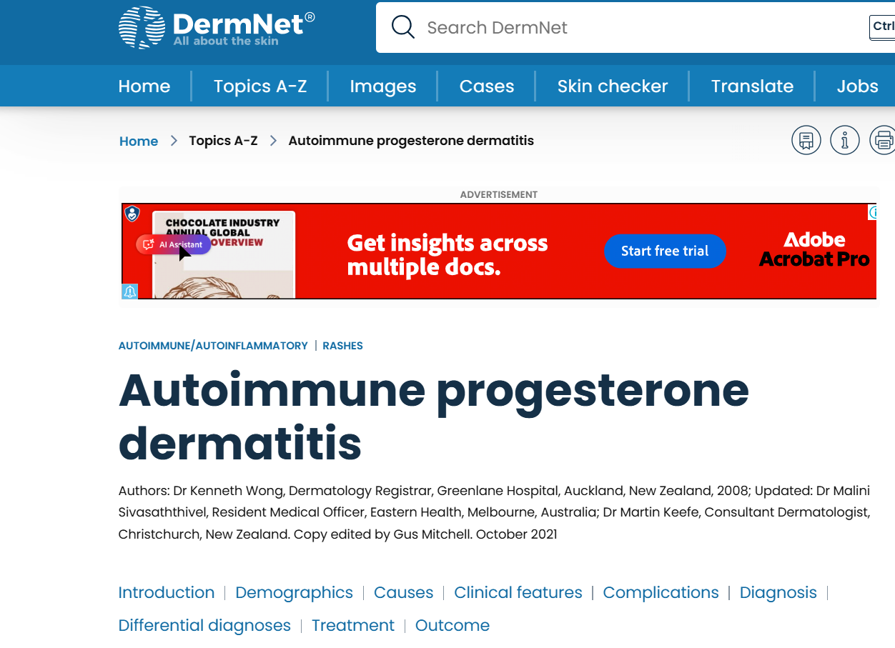 Prosterone Rash Autoimmune Progesterone Dermatitis
