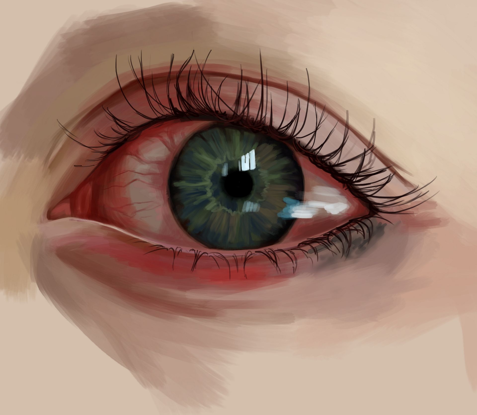 Close-up of a red, irritated eye with a blue-green iris and long eyelashes