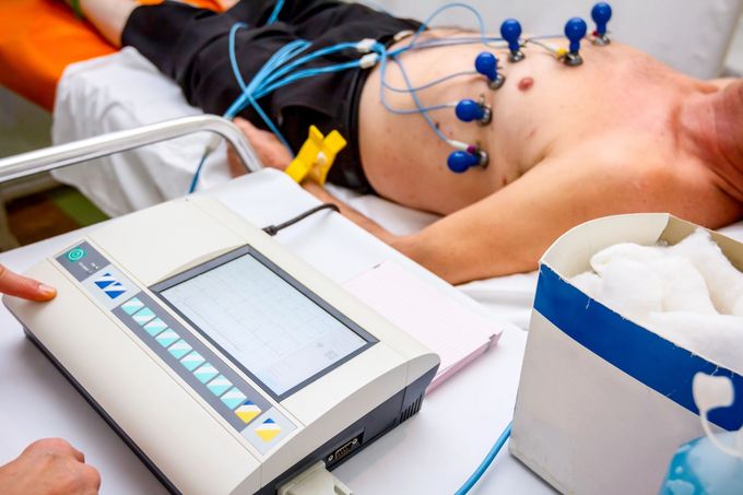 Una persona sdraiata su un lettino da visita medica mentre viene sottoposta a un elettrocardiogramma (ECG) con elettrodi toracici collegati.