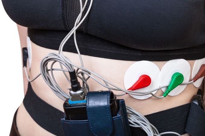 Un dispositivo di monitoraggio Holter indossato intorno alla vita con elettrodi applicati al busto tramite fili.