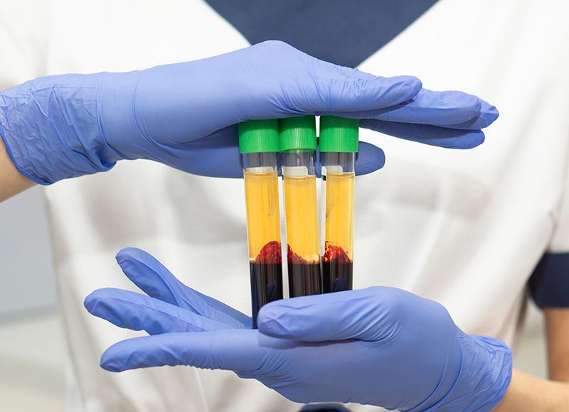 Holding Blood Plasma Holding Blood Plasma