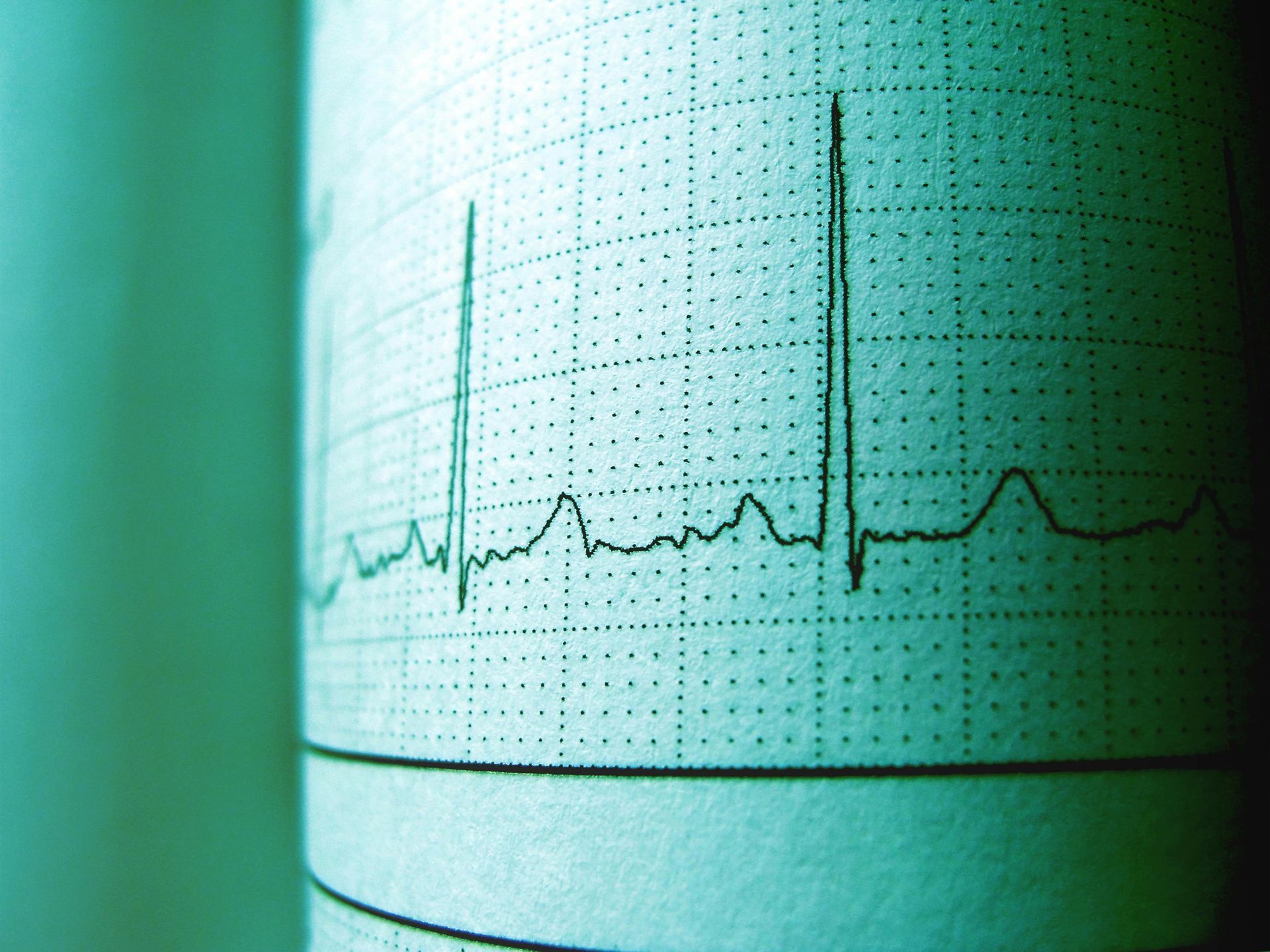 an electrocardiogram printout