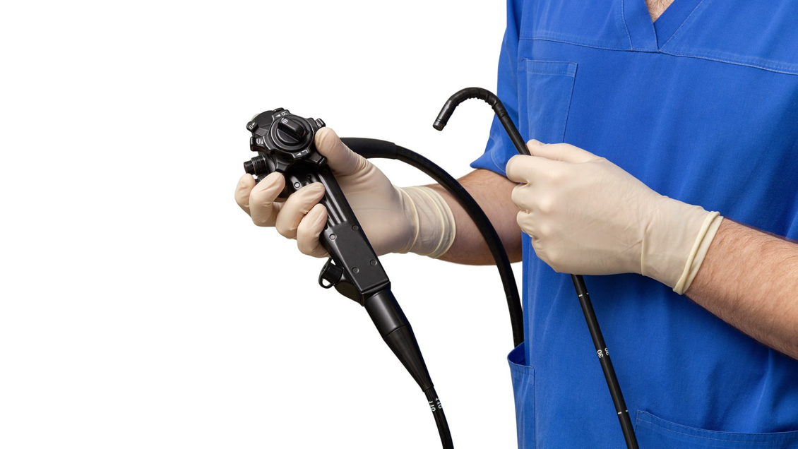 endoscopia