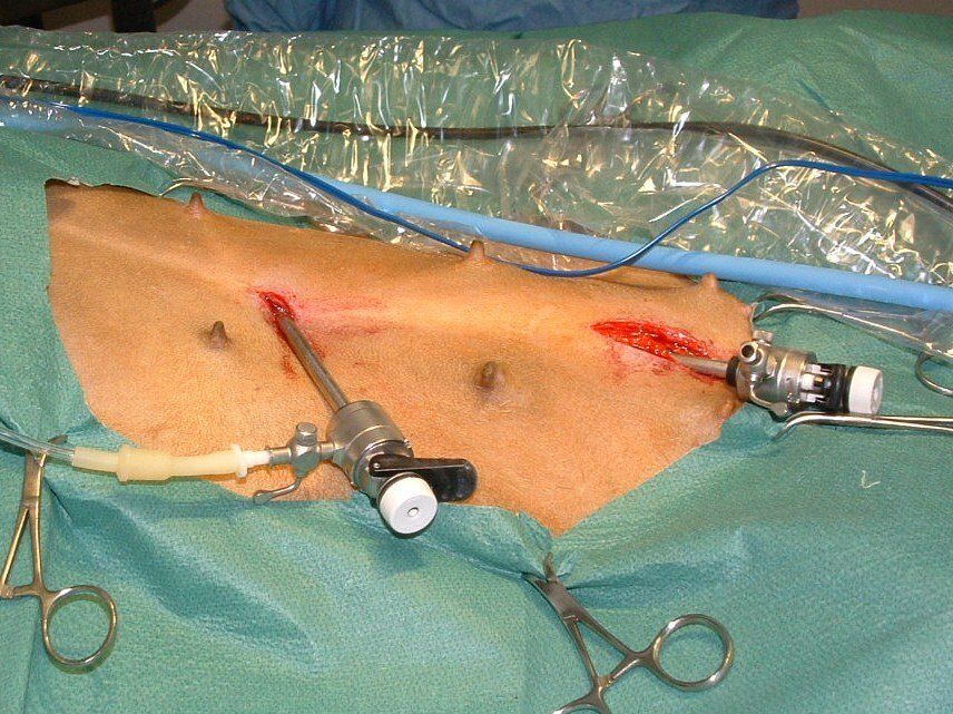 laparoscopia