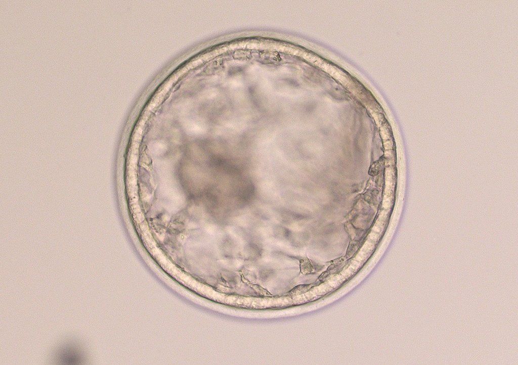 Embryo