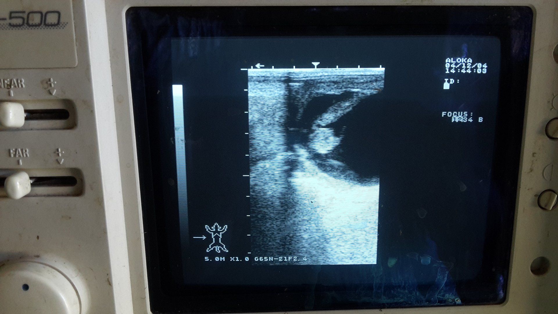 Scan