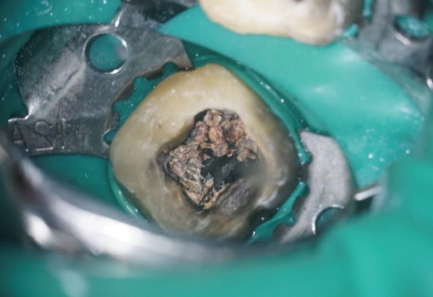 teeth