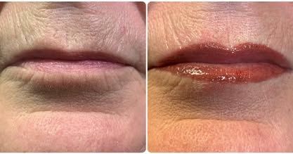 Before-and-after close-up of lips with muted natural color on the left and glossy reddish tint on the right