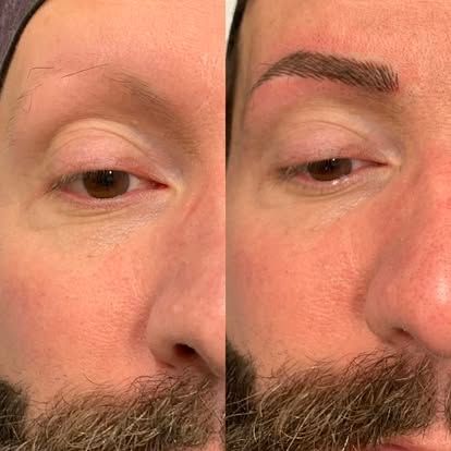 Close-up side-by-side face comparison showing a bare left eyebrow and a groomed dark eyebrow on the right.