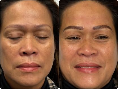 Side-by-side facial close-ups: eyes closed on the left, open and smiling on the right.