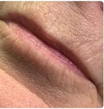 Close-up of closed lips with a visible pink crease and wrinkled skin texture