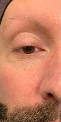 Close-up of a face with one eye, eyebrow, and part of a mustache visible.