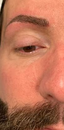 Close-up of a person’s face showing one eye, eyebrow, nose, and beard
