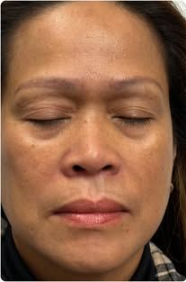 Close-up of a person with eyes closed and a neutral expression against a plain background
