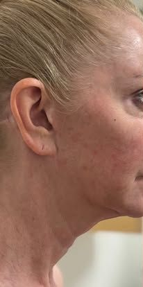 Close-up profile of an older person’s face with wrinkled skin and a small earring.