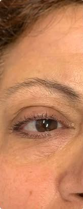 Close-up of a person’s eye and eyebrow with a neutral expression, partially visible face