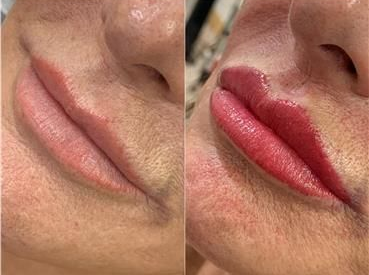Permanent Lip Make-up