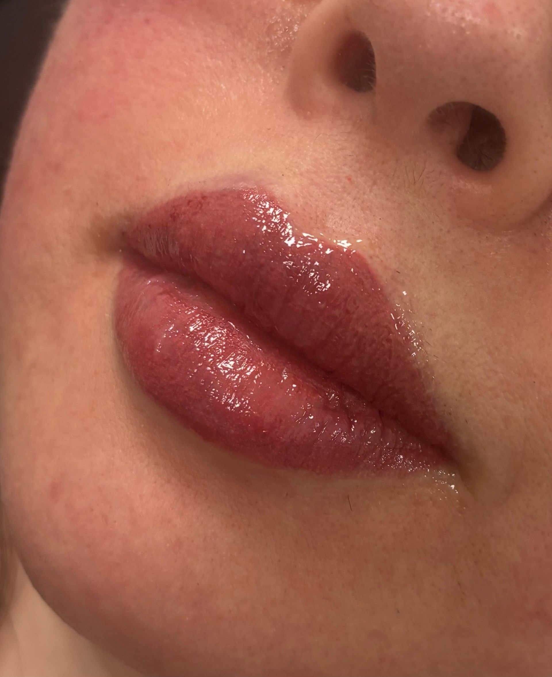Permanent Lip Make-up