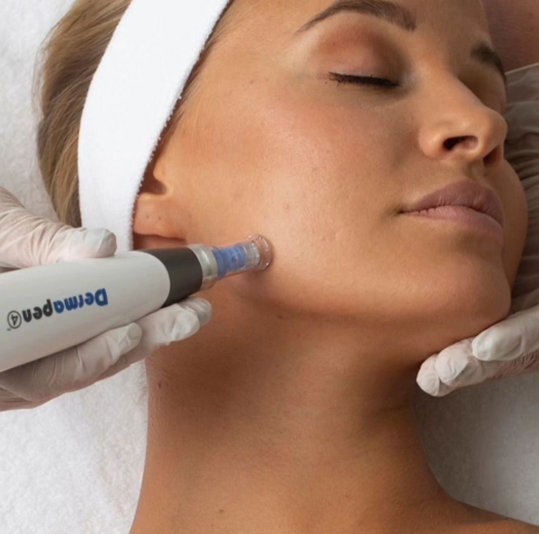 Dermapen Micro Needling - Portland, VIC - The Beauty Boutique