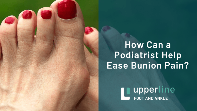 Podiatrist bunion treatment