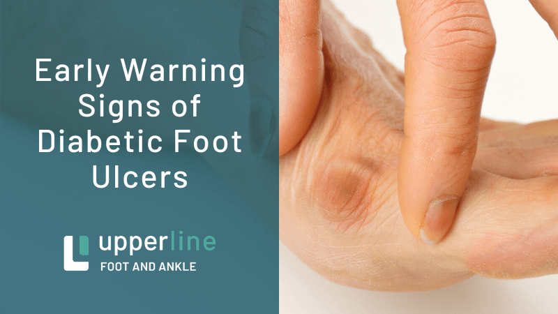 diabetic foot ulcers