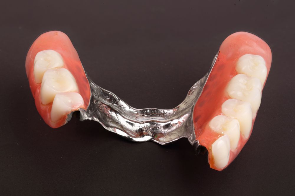 A Pair Of Dentures With A Metal Frame On A Black Surface — Dentures Direct Taree-Rod Hinton In Taree, NSW