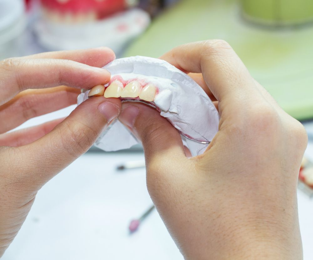 A Person Is Holding A Model Of Teeth In Their Hands — Dentures Direct Taree-Rod Hinton In Taree, NSW