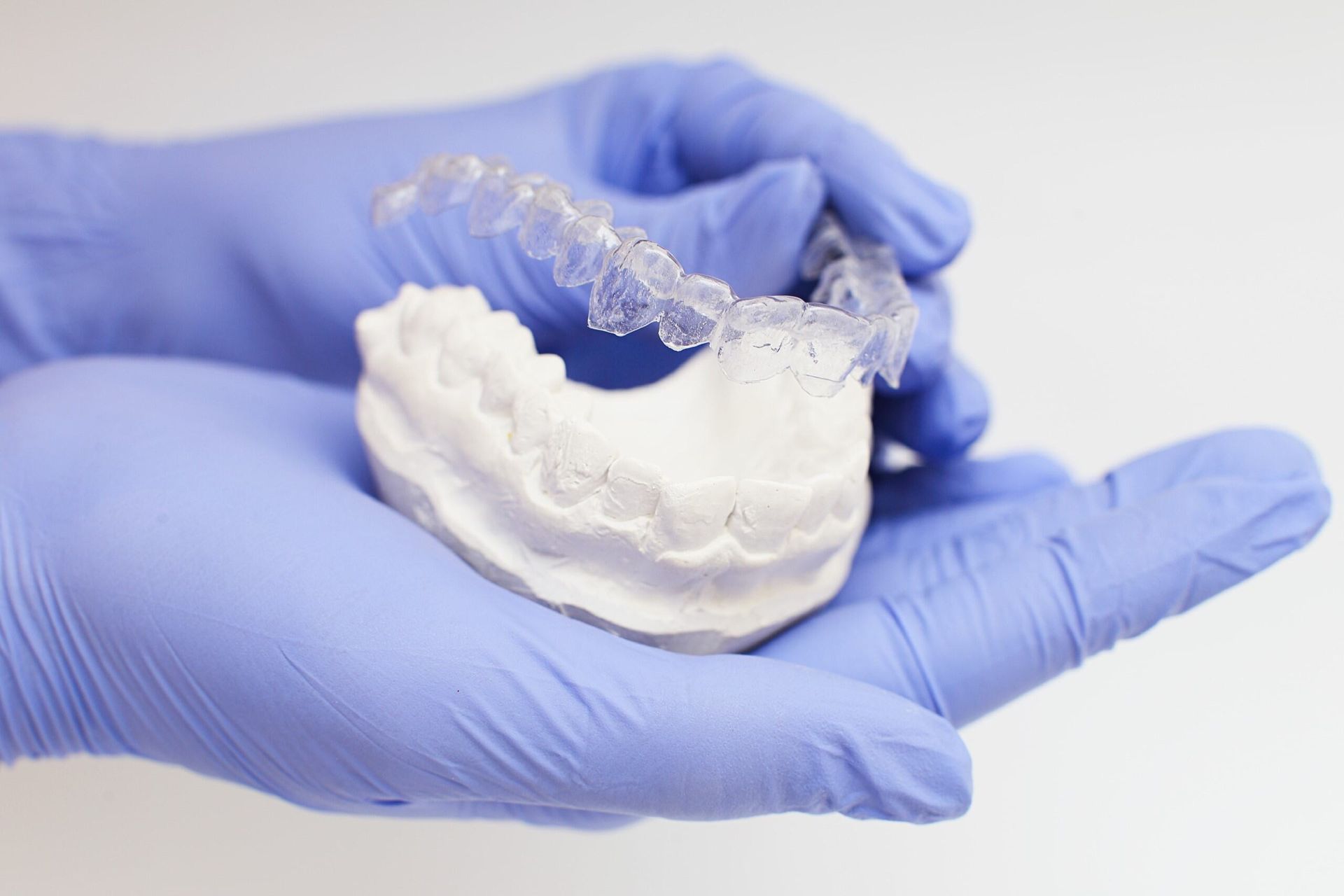 A Person Wearing Blue Gloves Is Holding A Model Of Teeth — Dentures Direct Taree-Rod Hinton In Laurieton, NSW