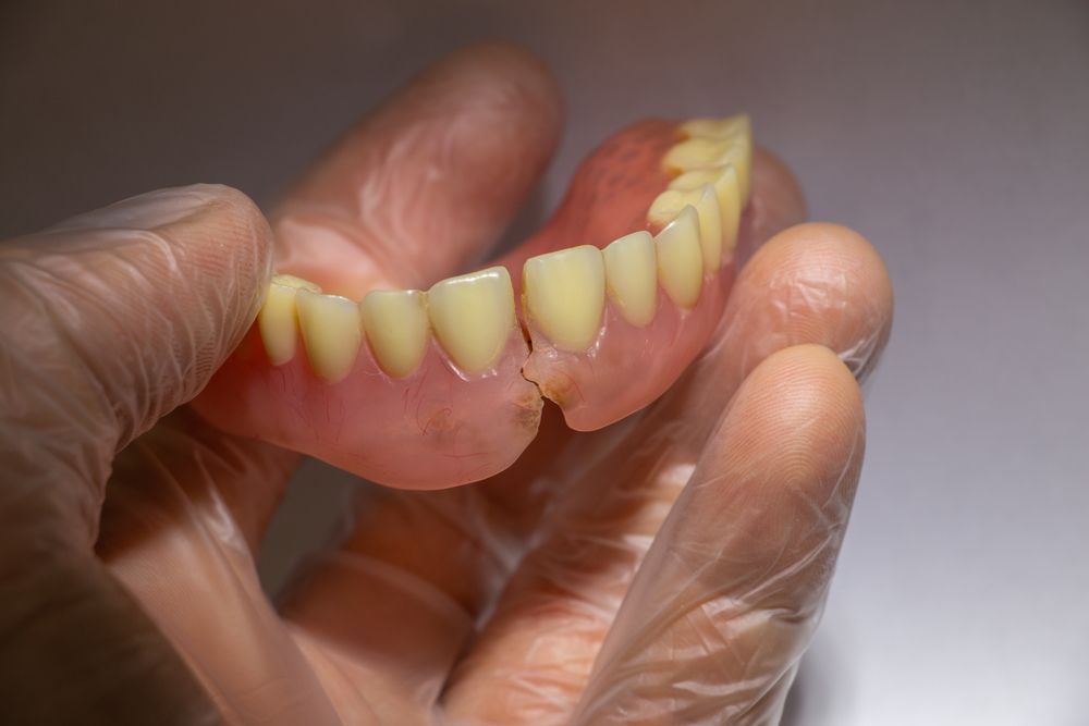 A Person Is Holding A Broken Denture In Their Hand — Dentures Direct Taree-Rod Hinton In Taree, NSW