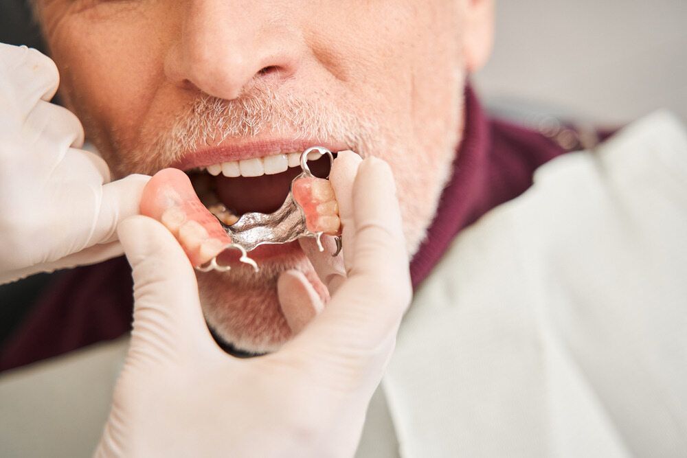 A Man Is Getting A Denture From A Dentist — Dentures Direct Taree-Rod Hinton In Taree, NSW