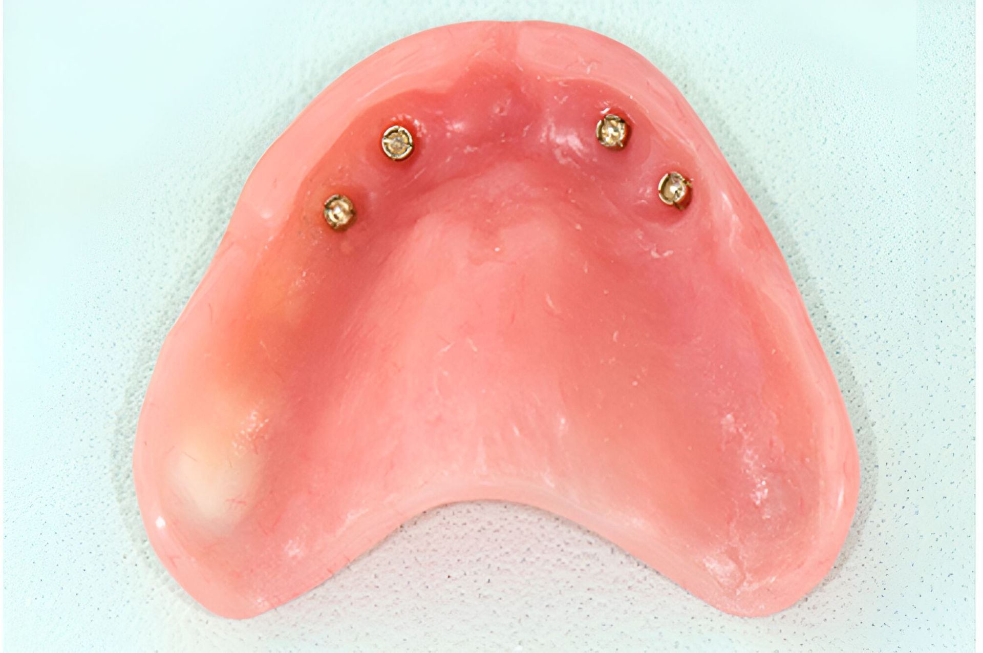 A Close Up Of A Denture With Screws In It On A White Surface — Dentures Direct Taree-Rod Hinton In Taree, NSW