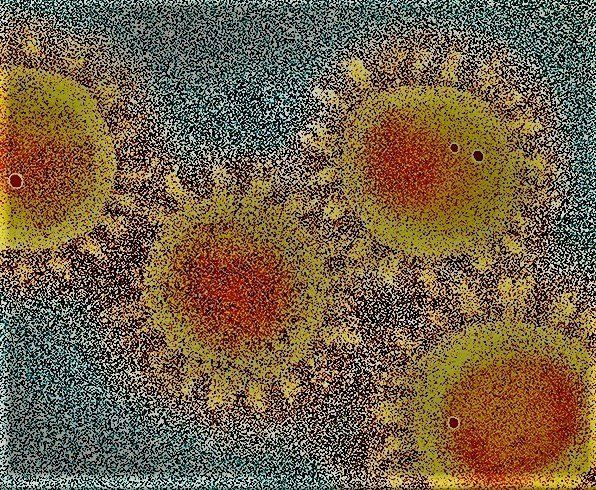 Virus — Covington, LA — Exit Biohazard & Crime Scene Cleanup Virus — Covington, LA — Exit Biohazard & Crime Scene Cleanup